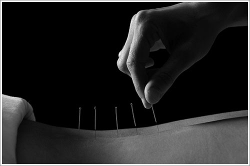 Align Chiropractic & Acupuncture in Fairmont, MN