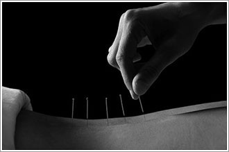 Align Chiropractic & Acupuncture in Fairmont, MN